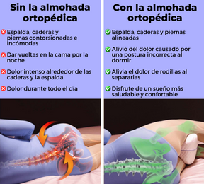 Almohada terapéutica para la espalda - alivia el dolor y mejora la postura - LEG PILLOW